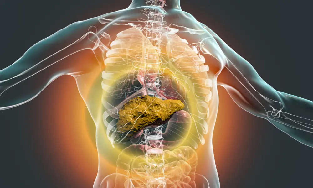 Fatty Liver Disease Affects 1 in 4 People — A New Treatment Shows Promising Results