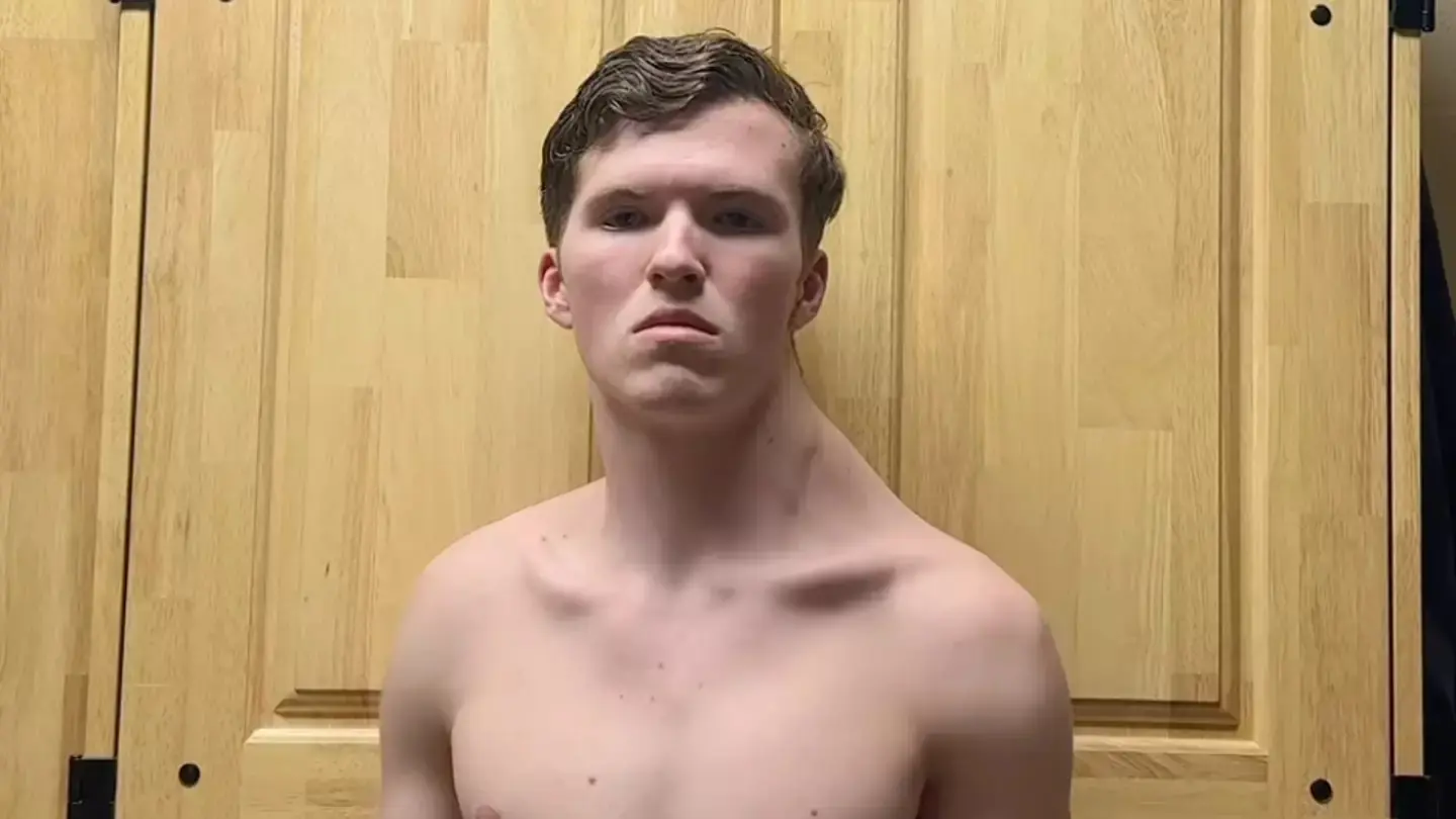 Teen Has Been Training Only One Side of His Body for 182 Days—And The Results Are Crazy