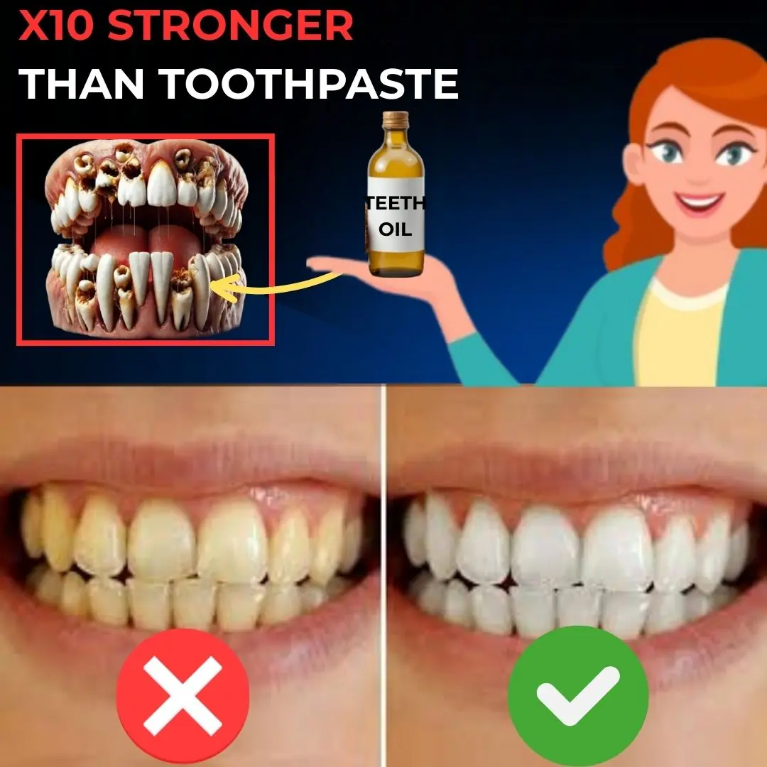 🦷 Reveals the Secret to Reversing Cavities in Just 24 Hours with This Simple Oil Trick!