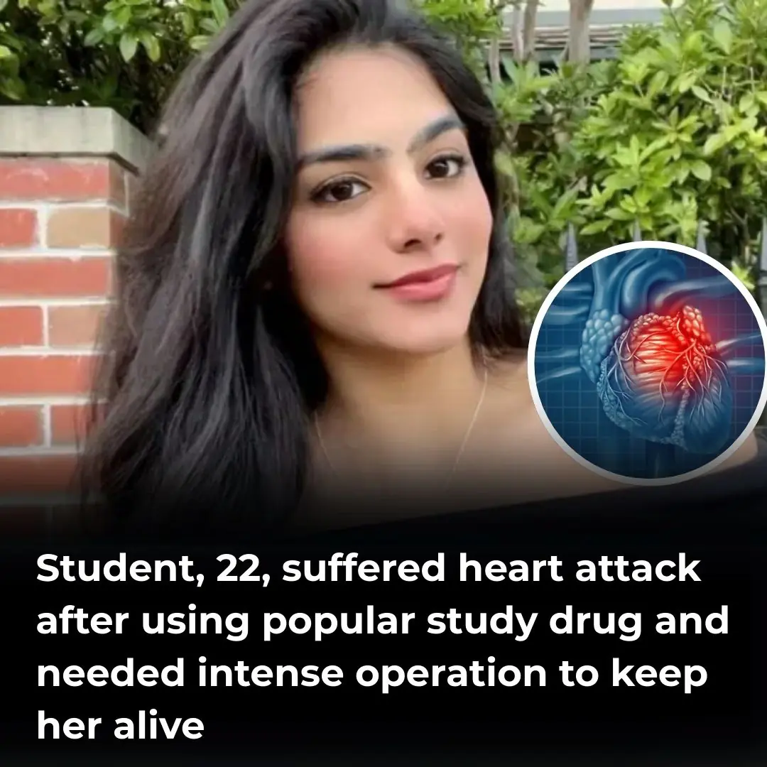 Student, 22, suffered heart attack after using popular study drug and needed intense operation to keep her alive