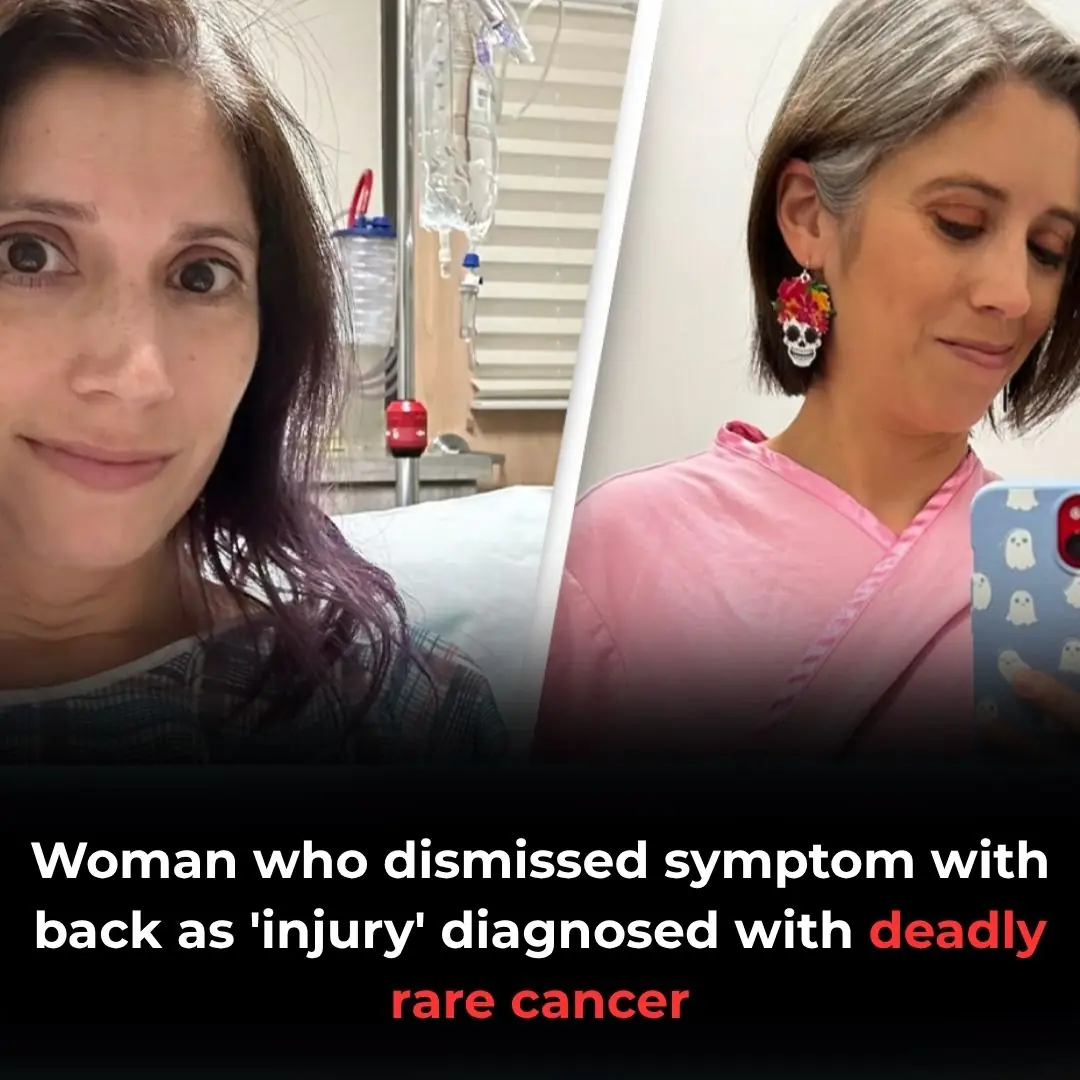 Woman who dismissed symptom with back as 'injury' diagnosed with deadly rare cancer