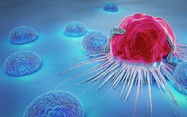 "On the Brink of Cancer: 5 Warning Signs Your Body Sends — Unusual Pain, Persistent Cough? See a Doctor Before It’s Too Late