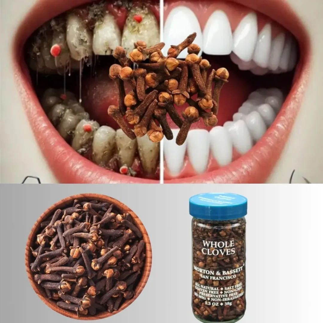 9 Natural Ways to Remove Plaque & Tartar Buildup