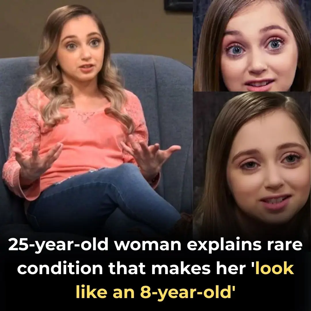 25-year-old woman explains condition that makes her ‘look like an 8-year-old’