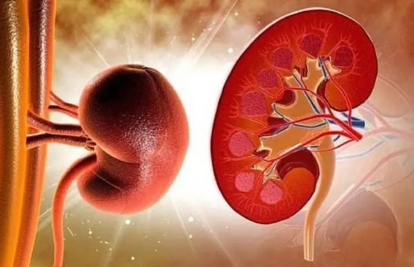 5 Early Signs of Kidney Failure You Need to Know: #3 Is Common But Often Ignored