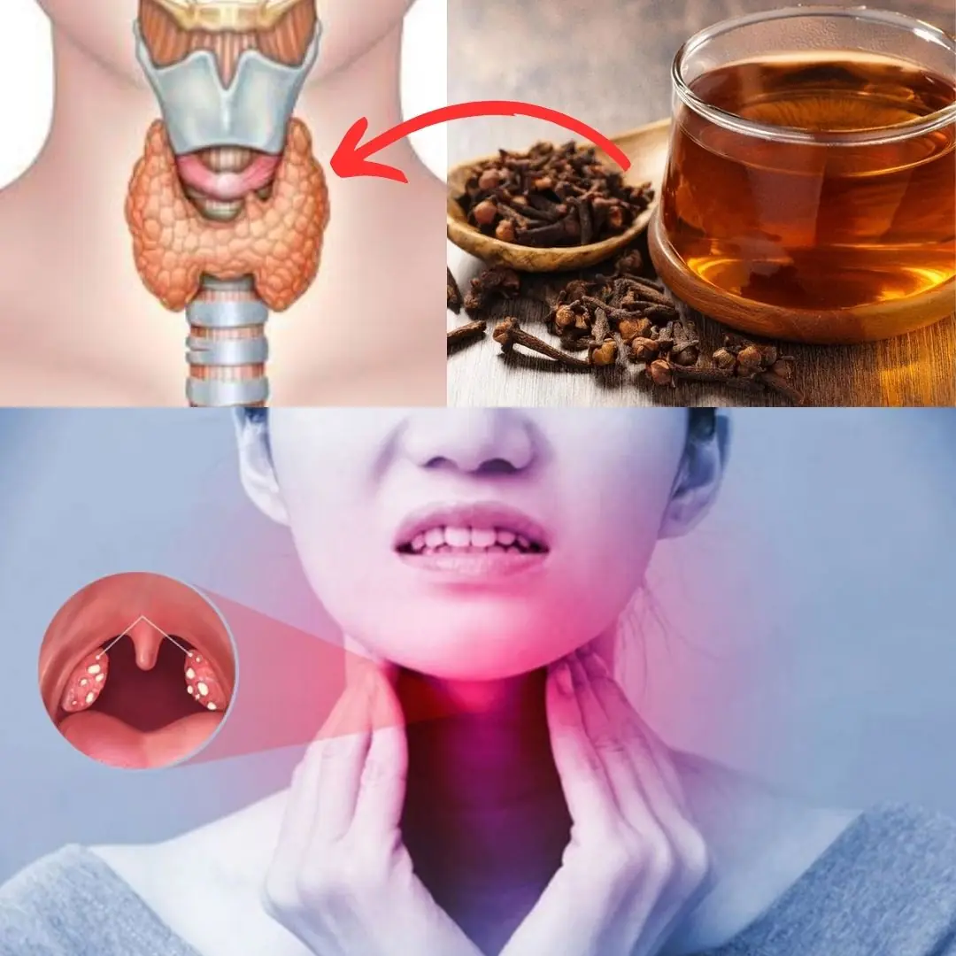 Kills Sore Throat and Inflammation – Cloves: Nature’s Antibiotic! 🌿🧄✨