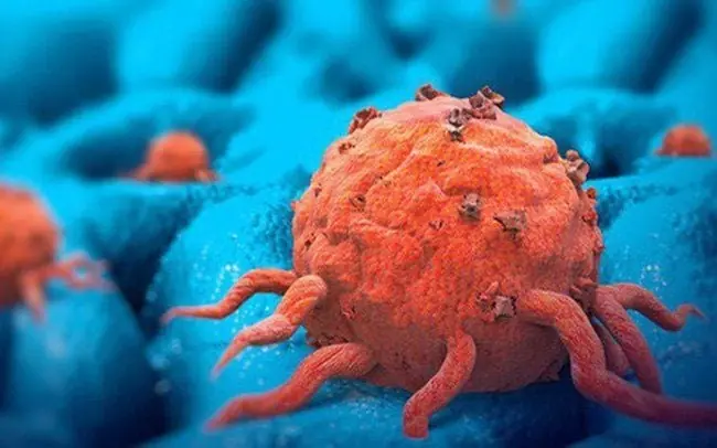 If You Don’t Get These 5 Health Screenings, You Might Not Know You Have Cancer! It's Best to Check These Areas Regularly