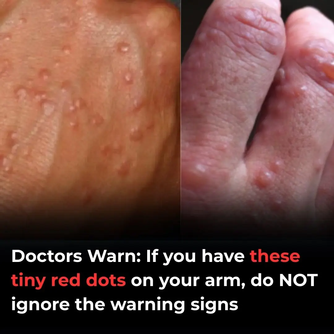 Don’t overlook these small red spots on your arm – They could be important warning signs