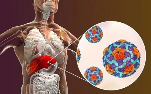 5 Early Warning Signs of Liver Cancer You Should Never Ignore—Even If They Seem Subtle