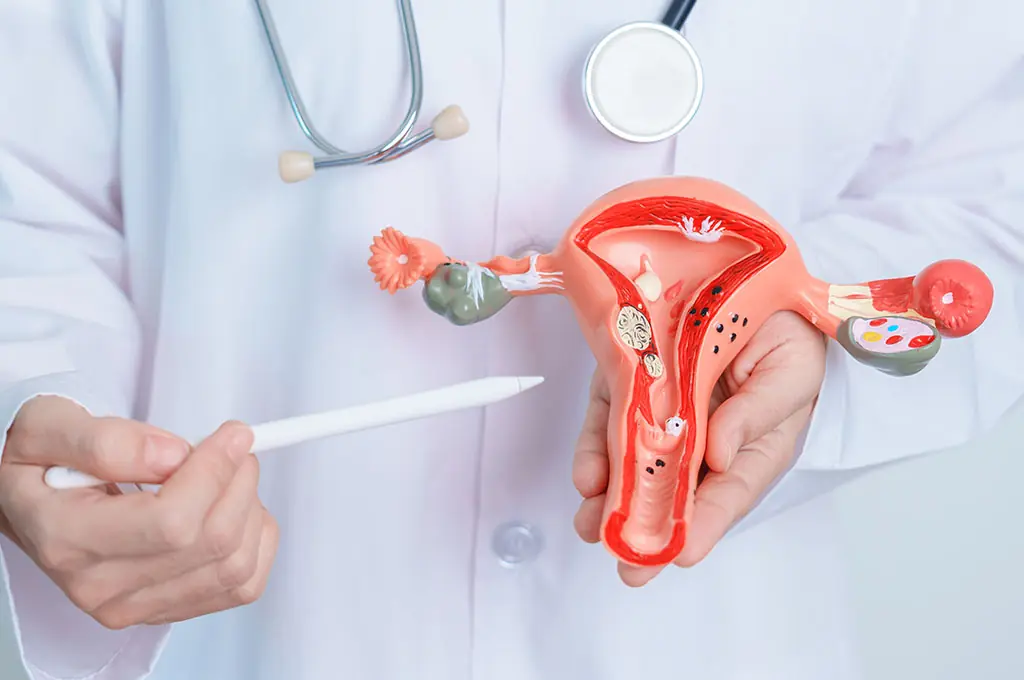 New Study Reveals Strong Genetic Link Between Endometriosis and Immune Disorders