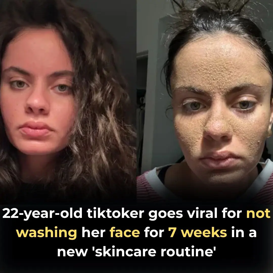 22-year-old tiktoker goes viral for not washing her face for 7 weeks in a new ‘skincare routine’