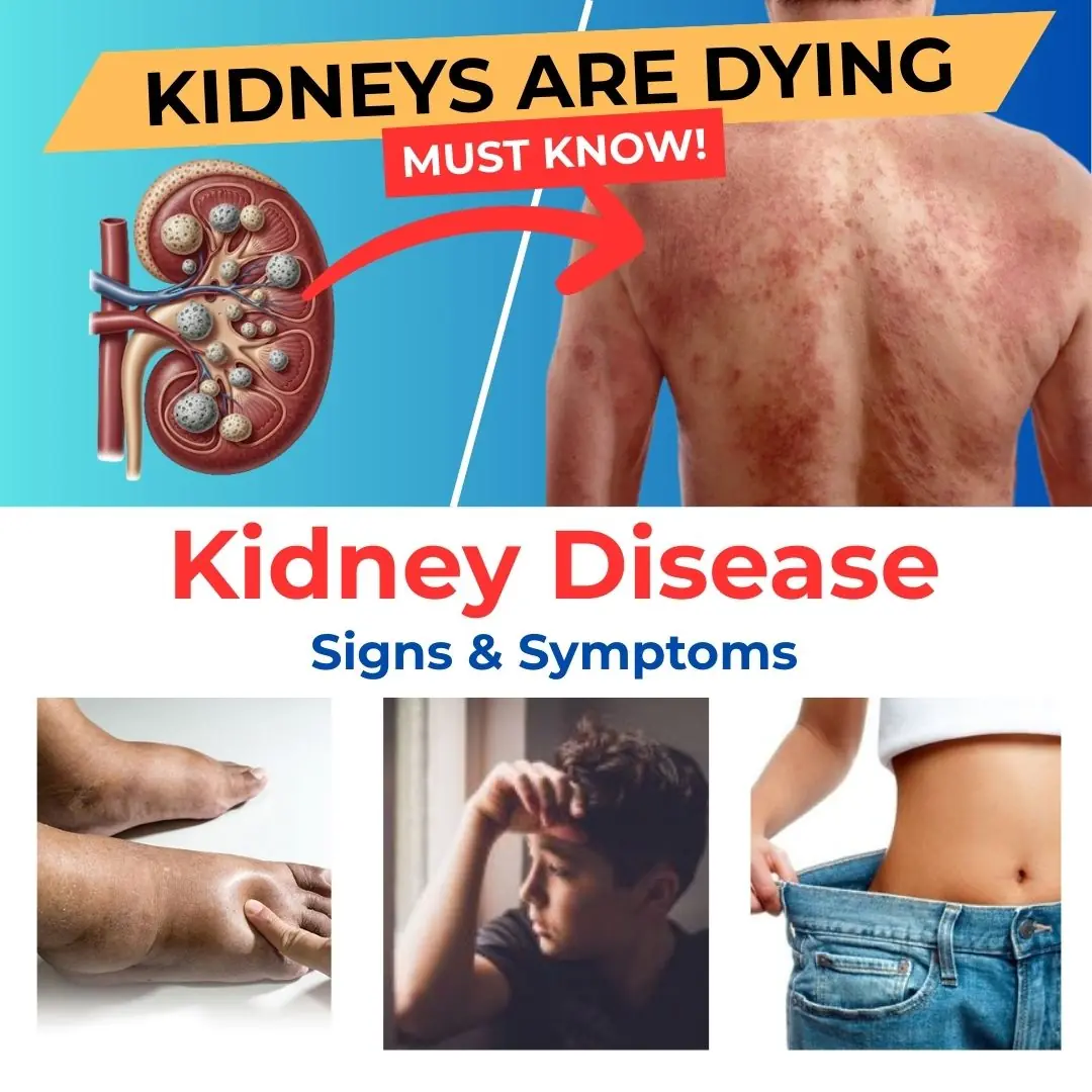 23 Unusual Warning Signs of Kidney Disease You Should Never Ignore