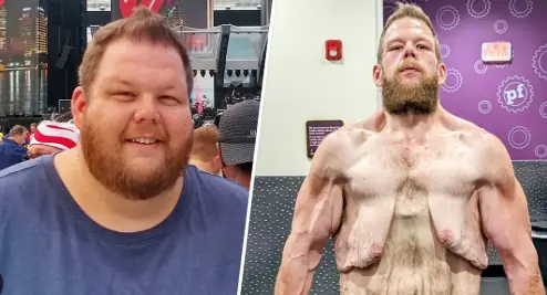 Man Loses 400 Pounds Naturally and Raises Funds to Remove Excess Skin