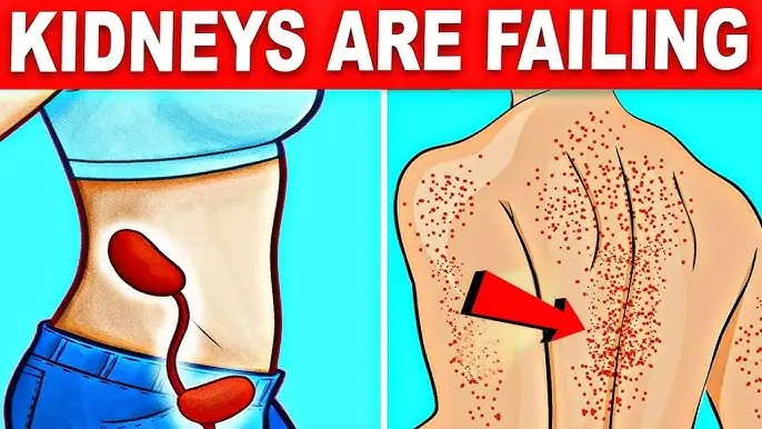 10 Warning Signs Your Kidneys May Be in Trouble