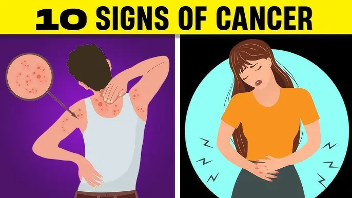 Is Your Body Trying to Tell You Something? 15 Early Signs of Cancer