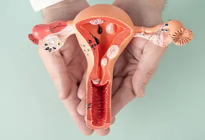 Understanding Uterine Fibroids: Causes, Symptoms, and Treatment Options