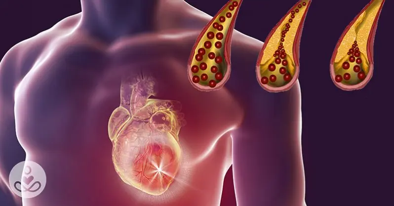 10 Foods You Should Eat Daily to Keep Your Arteries Clean