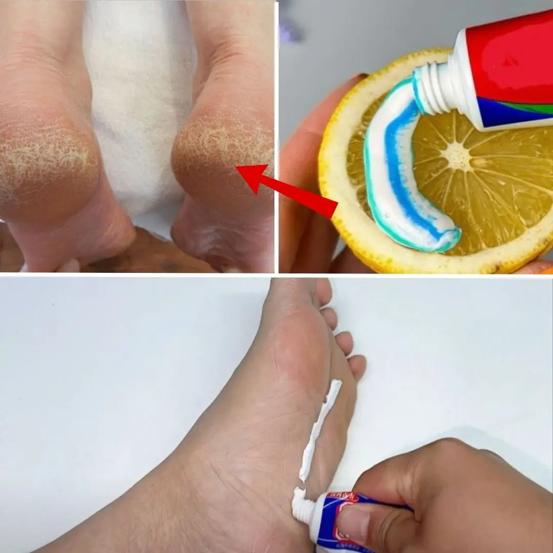 Toothpaste: The Secret to Happy Feet!