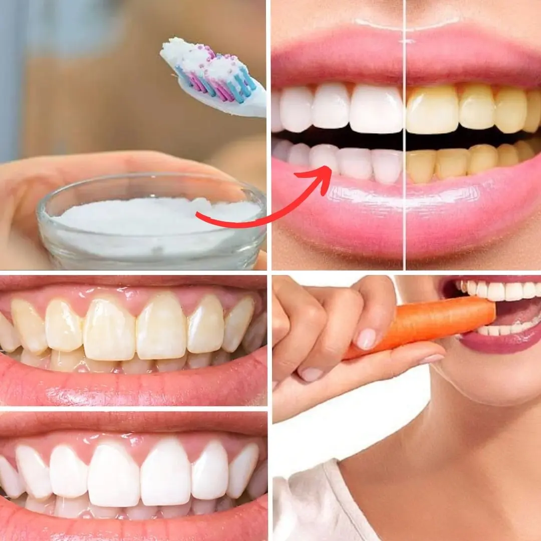 11 Natural Ways to Whiten Your Teeth Using Everyday Ingredients