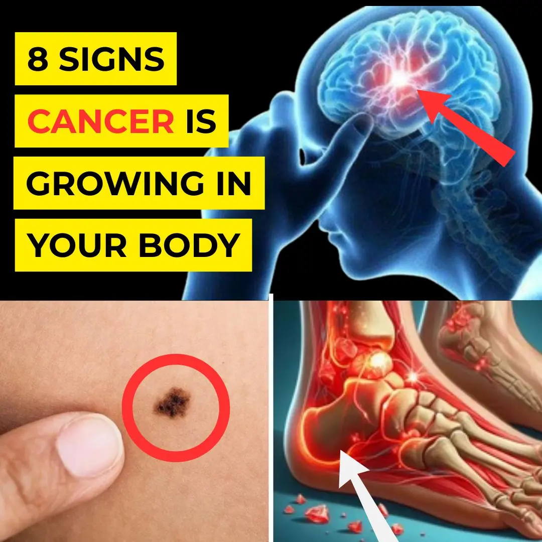 🚨 Over 30? Cancer Could Be Hiding in These 8 “Harmless” Symptoms You Shouldn’t Ignore