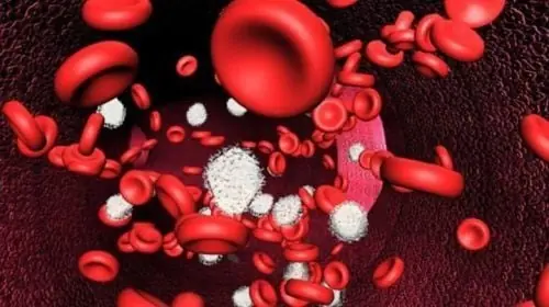 Cancer Cells Destroyed in 42 Days by a Glass of Juice: A Stunning Success That Has the World Celebrating
