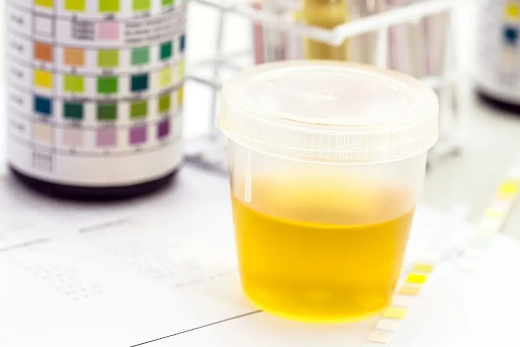 What Can Your Urine Tell You About Your Health?