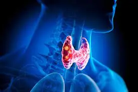 Top 13 Signs That You May Have a Thyroid Disorder
