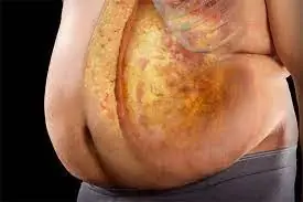 More and More People Are Suffering from Visceral Fat! Doctor: 9 Foods That Help Reduce Visceral Fat – Eat Them Regularly