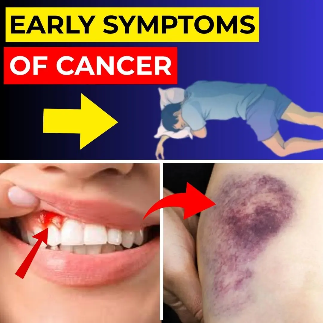 12 Early Cancer Signs You Can't Ignore | Healthy Care