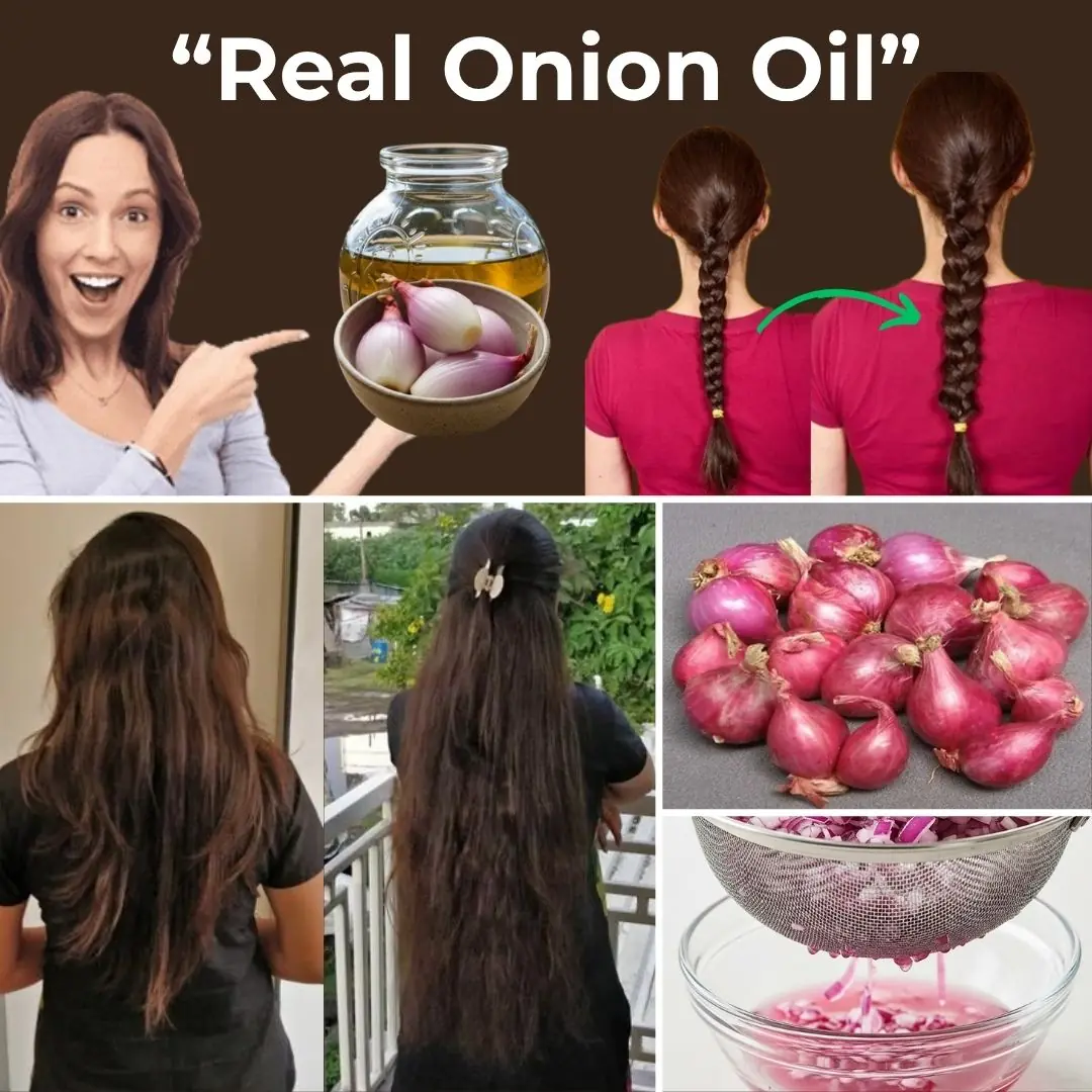 How to Make Onion Hair Oil for Faster Hair Growth and to Stop Hair Fall