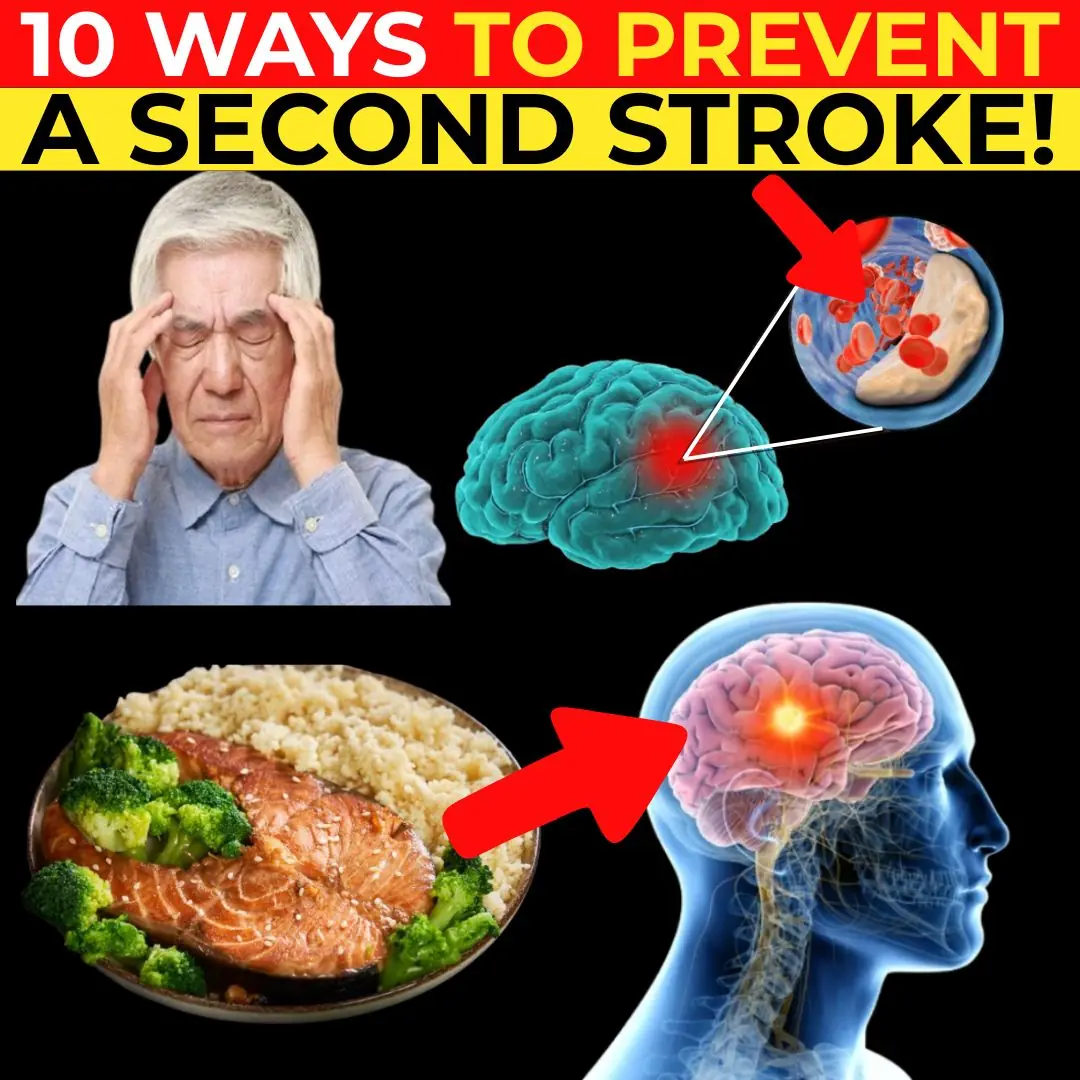 How to Reduce Your Risk of a Second Stroke (10 Things You Can Do)