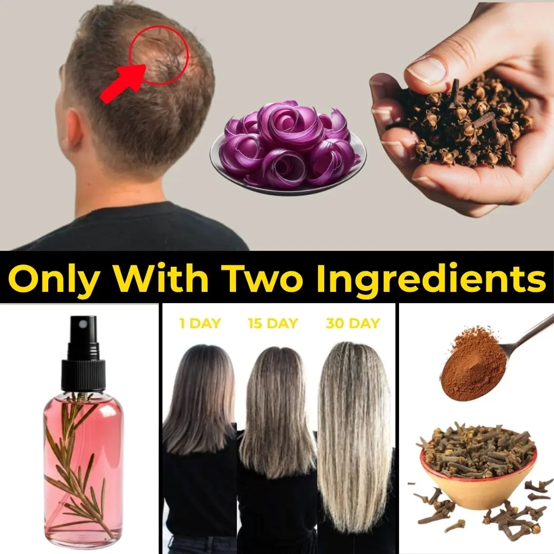 The Surprising Hair Growth Benefits of Cloves and Onion Peels