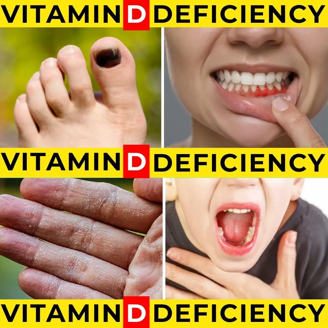 10 Signs Your Body Is Begging for Vitamin D