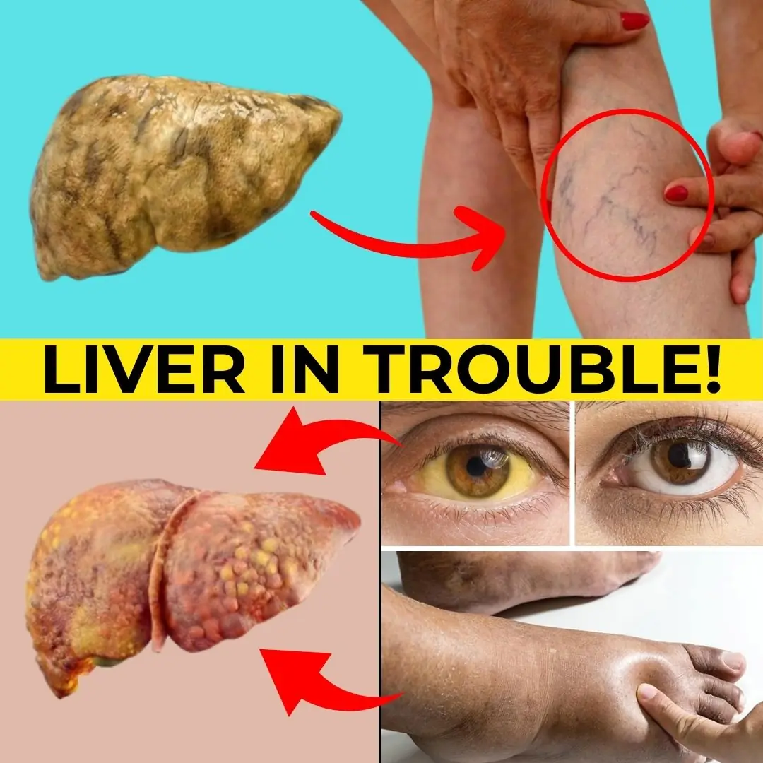 15 Early Warning Signs Your Liver Might Be in Trouble