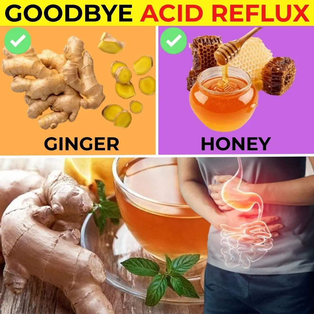 15 Powerful Foods to Relieve Acid Reflux Fast – The Ultimate Anti-Acidity Diet Guide