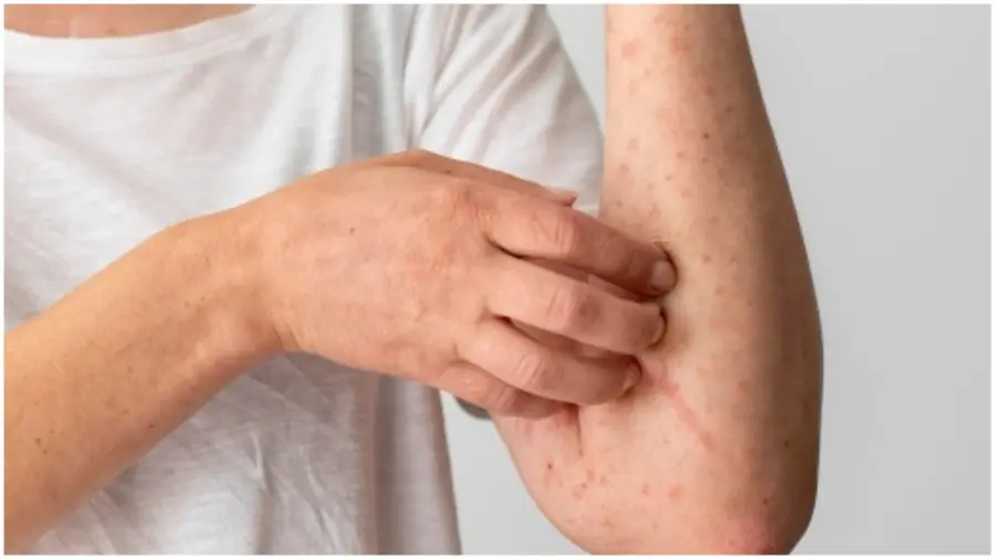 4 Warning Signs Your Liver Is in Trouble: Even Just One Means You Should See a Doctor ASAP