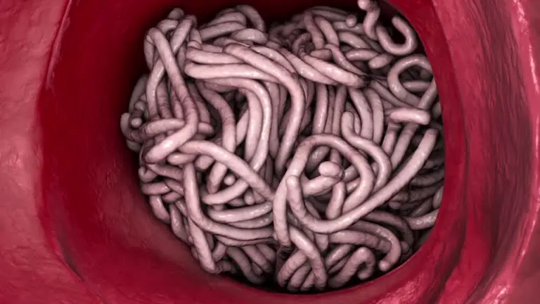 Natural Solutions for Intestinal Worms: Diet, Supplements & Home Remedies