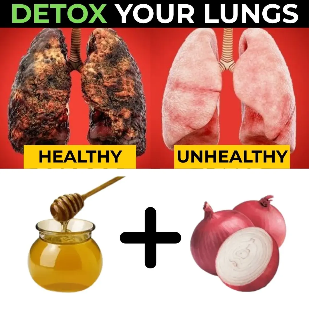 Breathe Easy Again: A Natural Way to Soothe Your Lungs with Onion and Honey