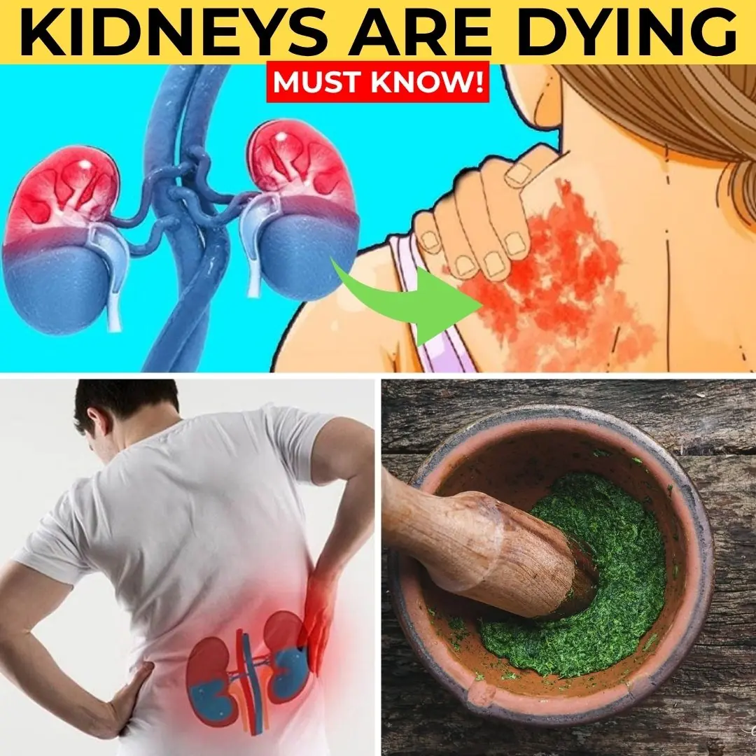 Kidney Danger! 10 Signs of Failing Kidneys & 8 Natural Detox Remedies You Shouldn’t Ignore