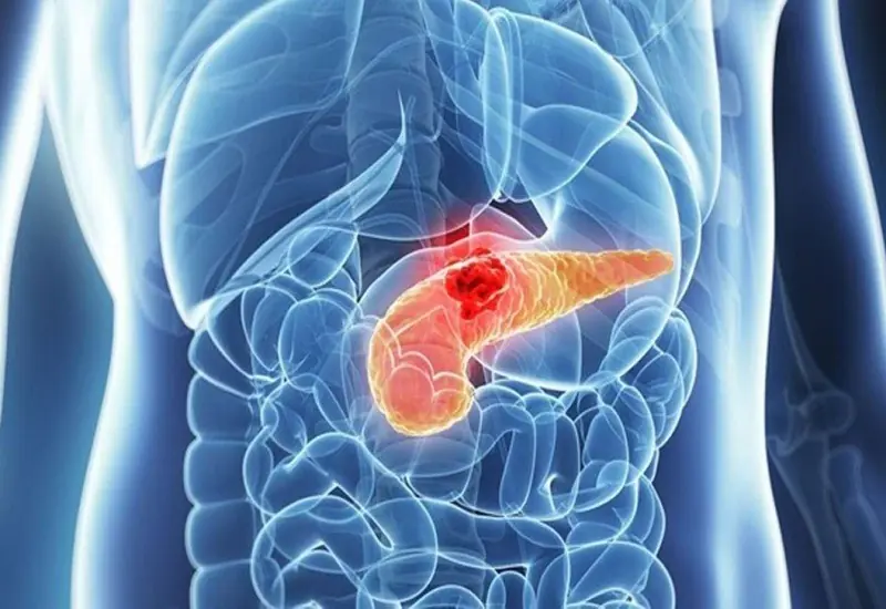 Skipping These Foods? You Might Be Missing a 22% Lower Risk of Pancreatic Cancer