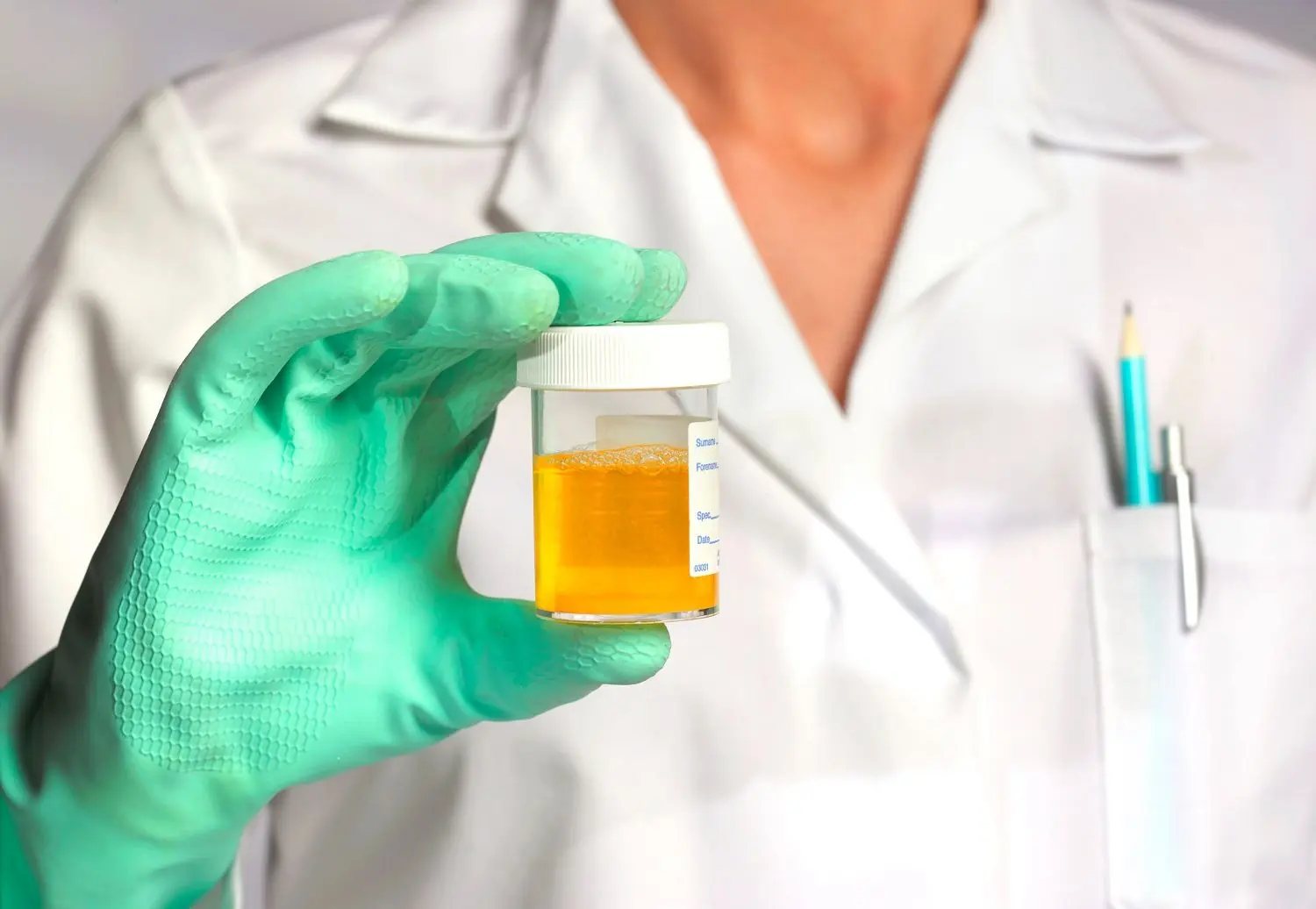 American Doctor Identifies 5 Warning Signs Your Liver Is Overloaded – Seek Medical Attention Even If You Have Just One