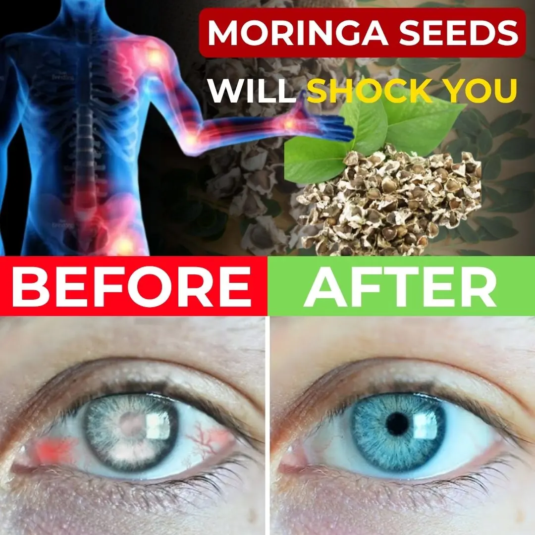 12 Moringa Seed Benefits You’ll Never Hear from Your Doctor (But You Should Know) 🌿✨