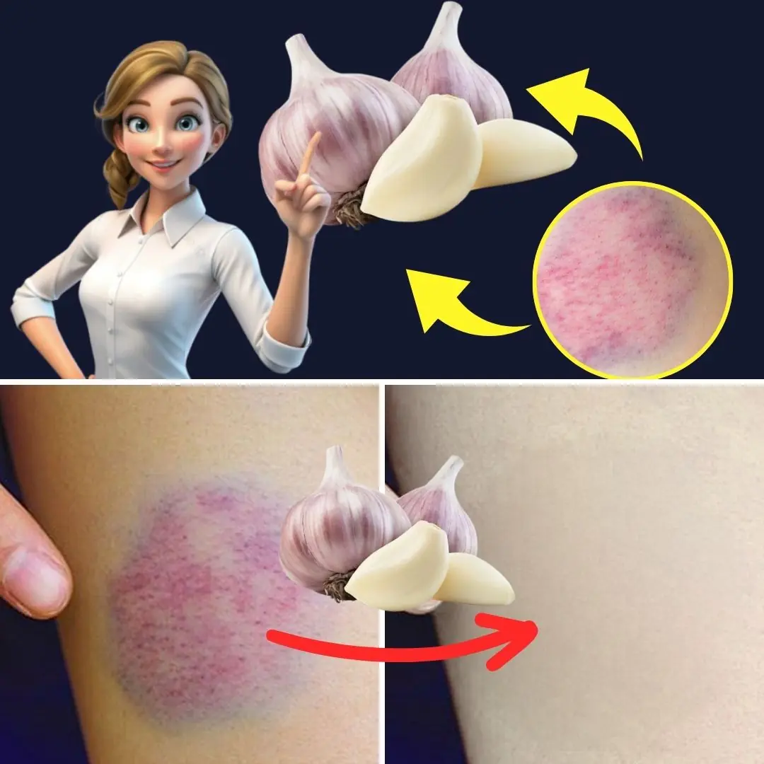 Can Garlic Support Healthier Veins Naturally?