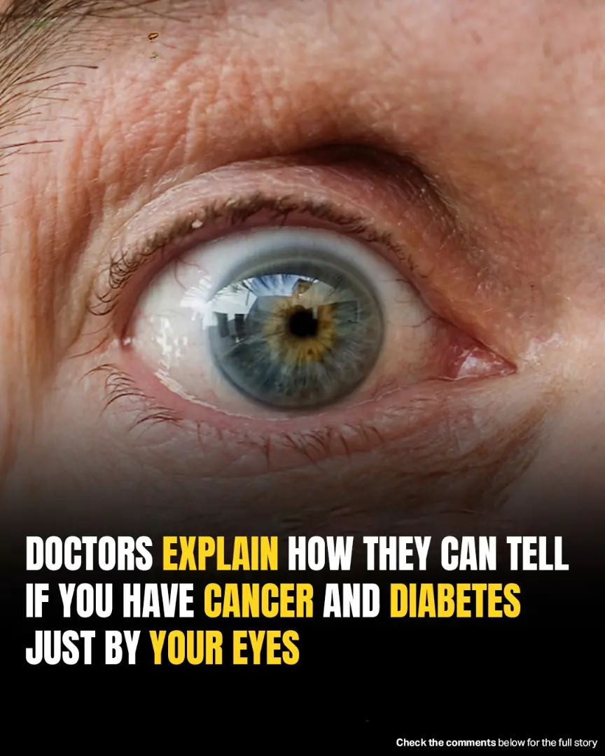 Doctors Reveal How Eye Exams Can Detect Signs Of Cancer And Diabetes