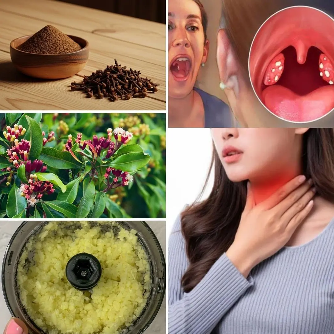 Soothe Your Throat Naturally: Home Remedies with Cloves