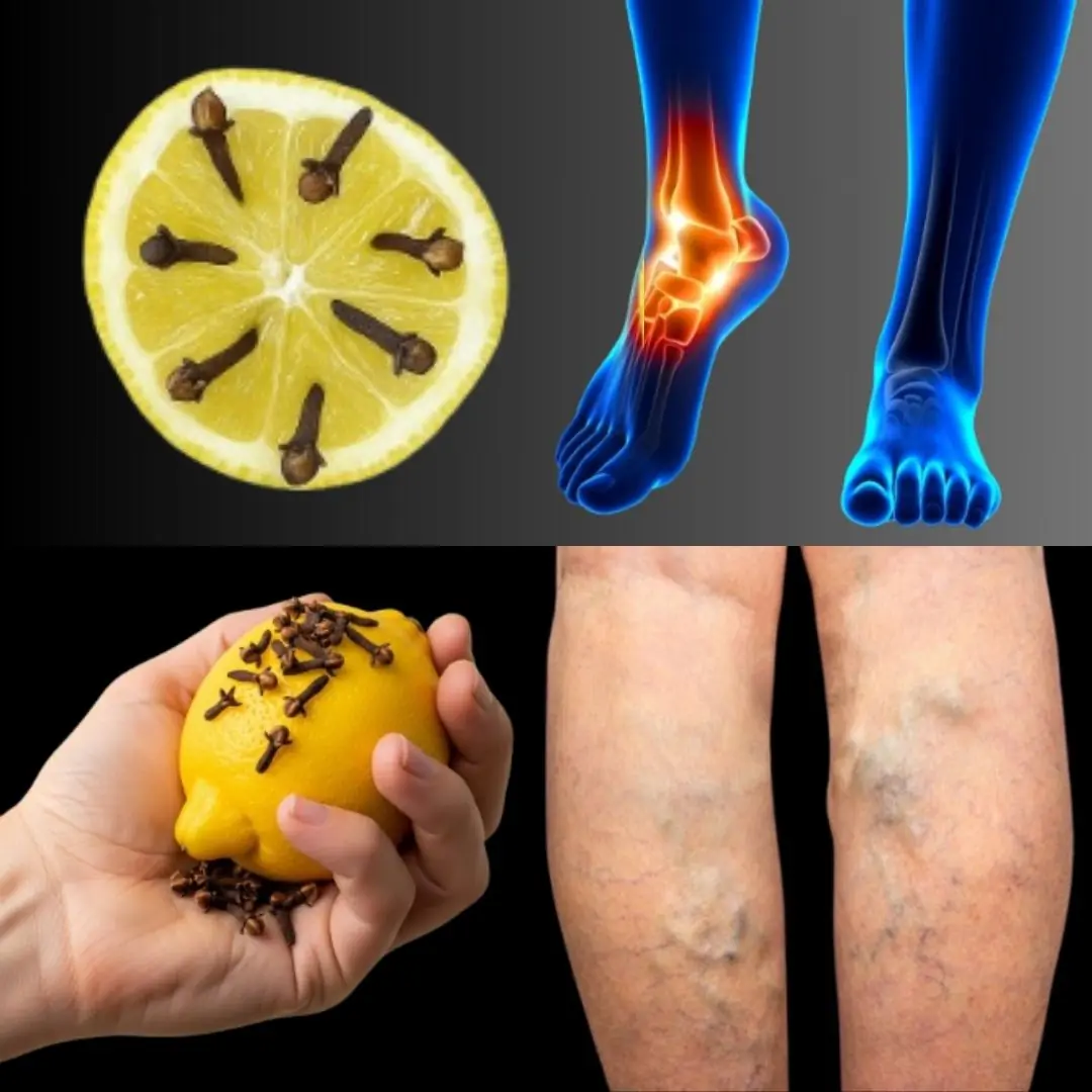 Mom’s Natural Remedy with Lemon: A Modern Cure-All for Pain and Inflammation 🍋🌿