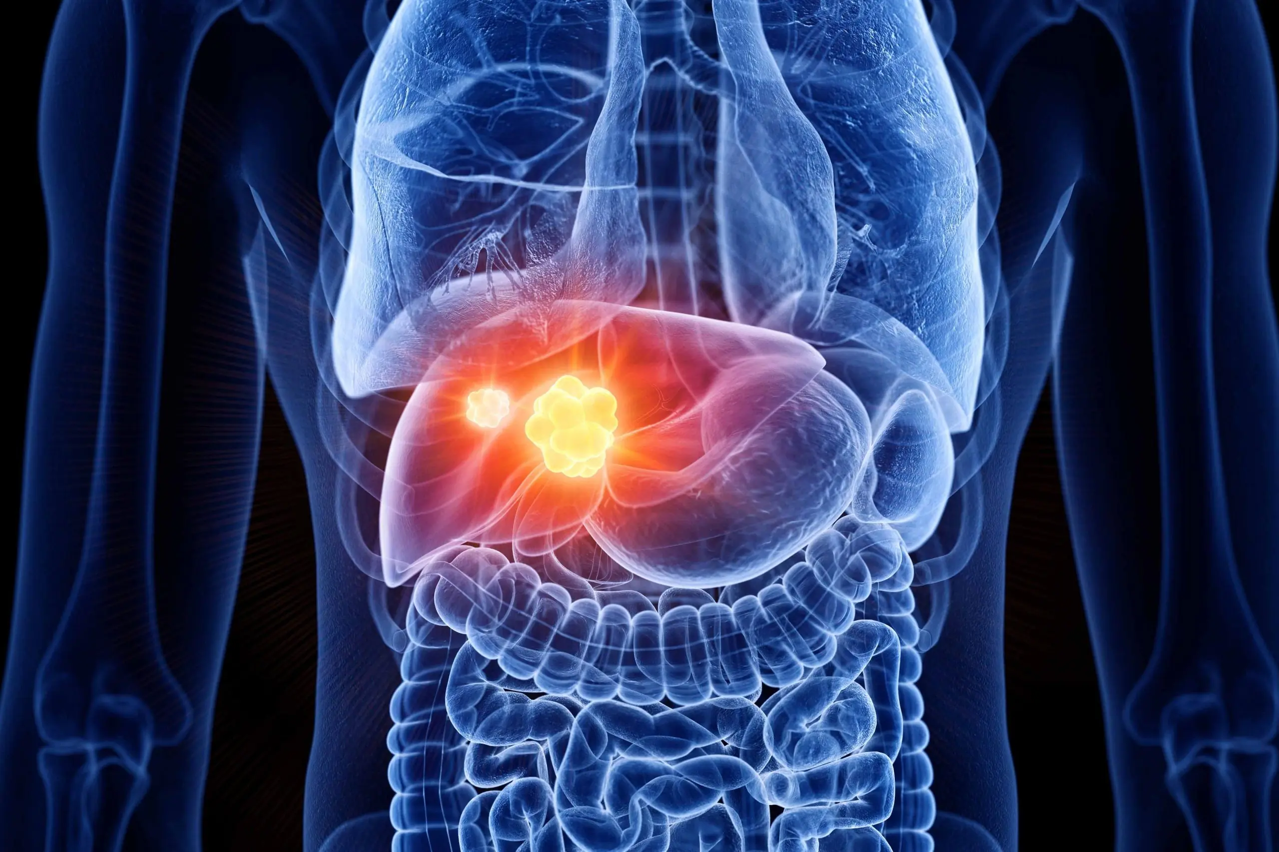 If Your Body Has a Bad Odor in These 3 Areas, It Could Mean Poor Liver Detox and Declining Function – Get Checked Before It’s Too Late!