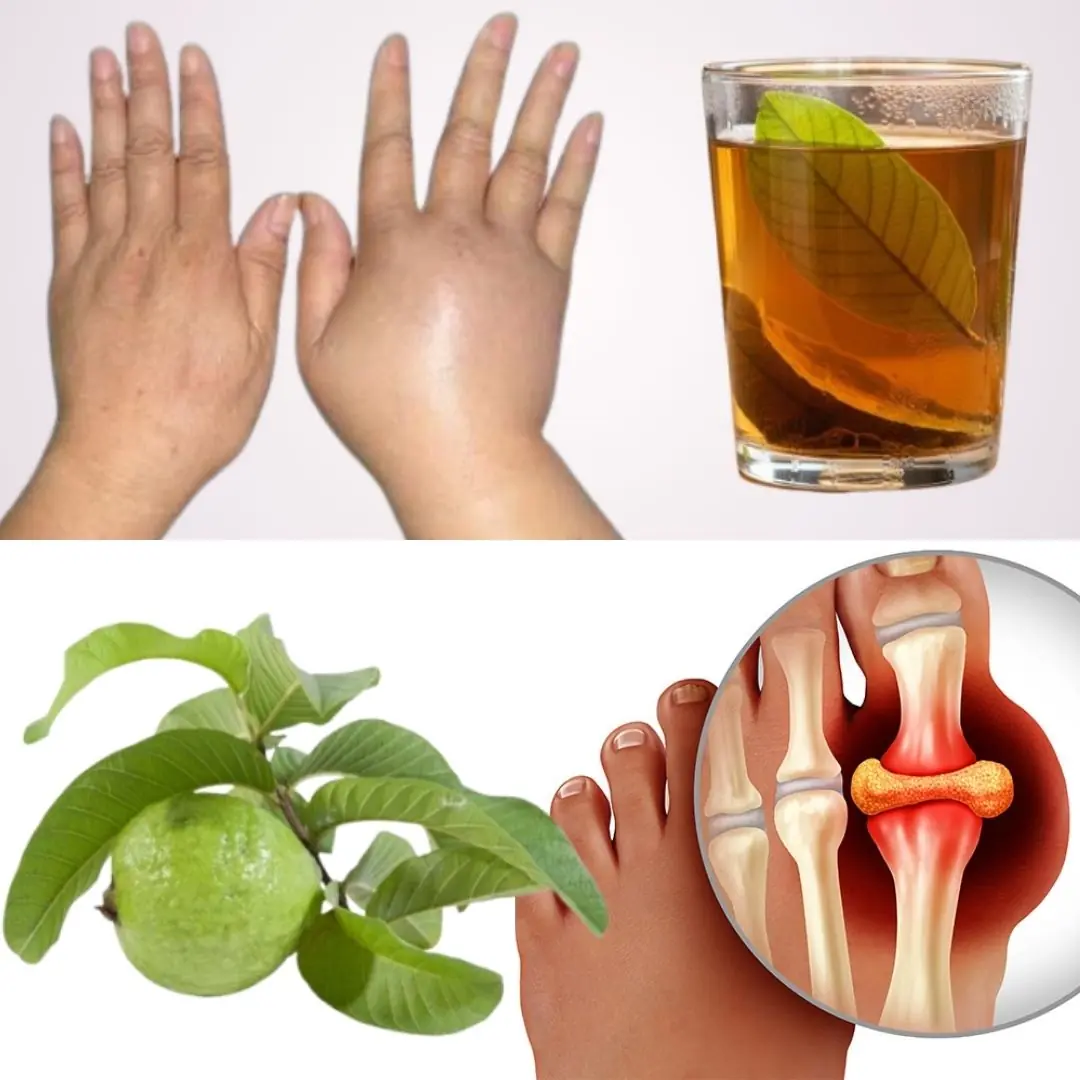 🌿 Guava Leaves for Water Retention: A Natural Remedy That Works