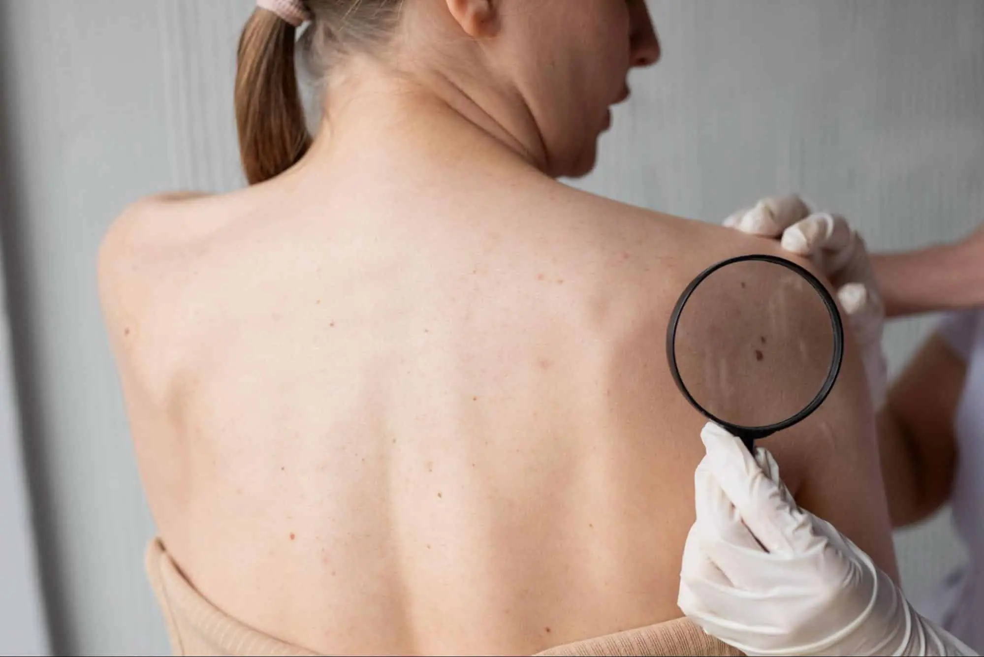 20 Subtle Cancer Symptoms Many People Miss