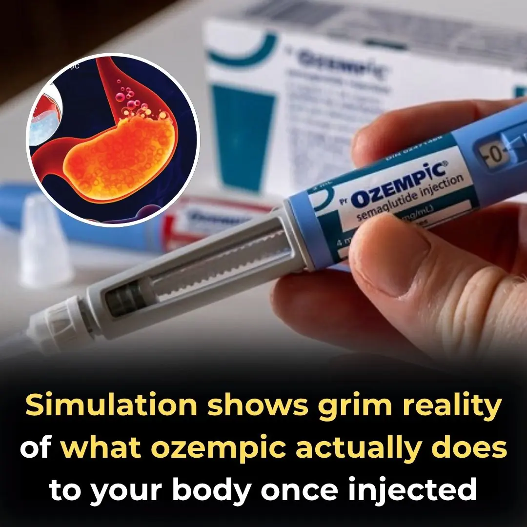 Simulation Shows Grim Reality of What Ozempic Does to Your Body Once Injected